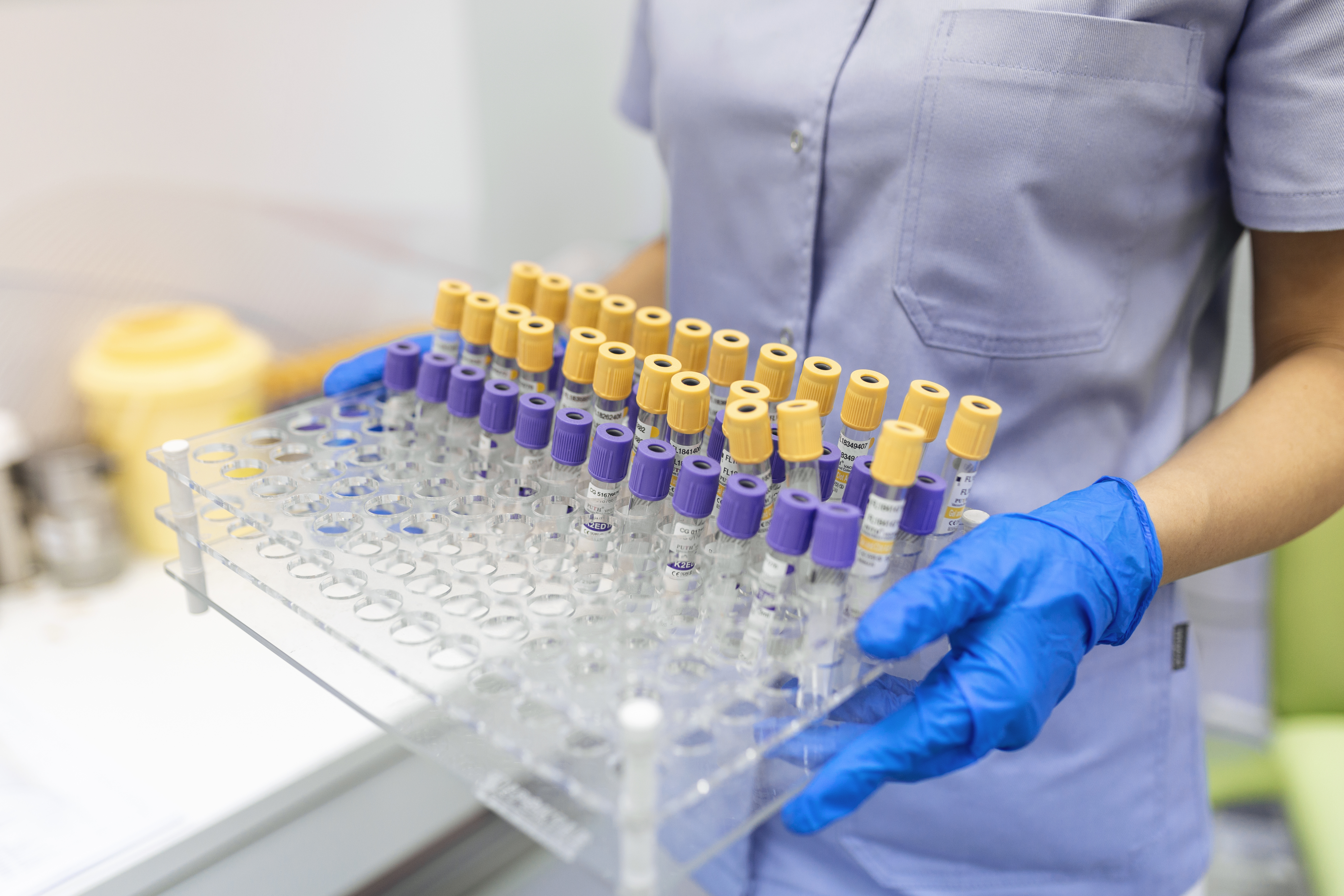 Laborvizsgálat vénás vérvétel